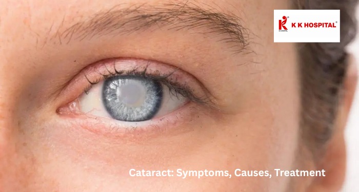 Glaucoma: The Silent Threat to Vision You Should Not Ignore